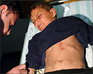 Photo of an injured Palestinian boy on a hospital bed with an expression of anguish on his face.