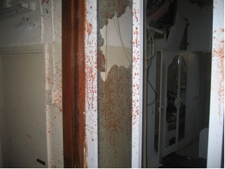 This fateful morning he had been sleeping with his pregnant wife when the Israeli soldiers arrived and knocked down the door of his house. He too had been shot in the face through the glass when he went up to the door.