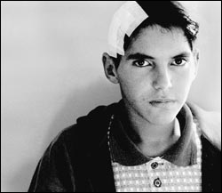 Boy with large bandage on his head: 
Ahmed Zakhi, 15, spent 20 days in a coma.